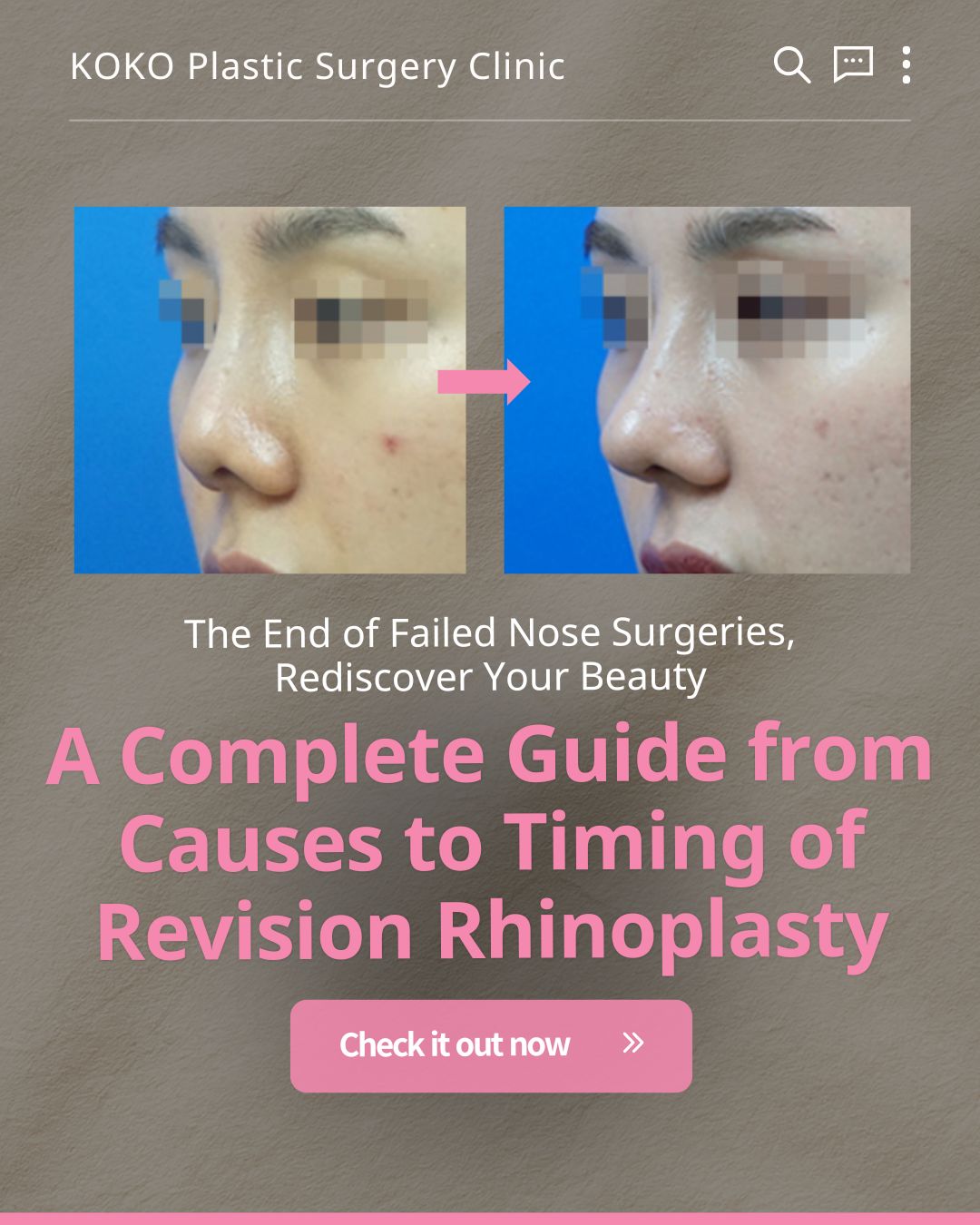 Revision Rhinoplasty in Korea: Safe Custom Nose Repair
