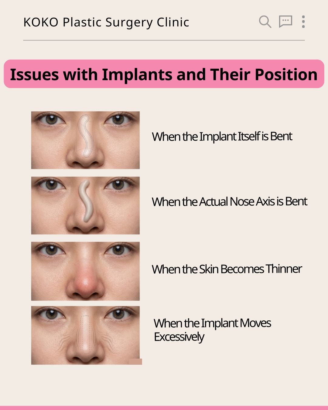 An infographic from KOKO Plastic Surgery Clinic titled "Structural Deformation and Severe Side Effects." It displays three illustrations from top to bottom: "Contracted Nose" showing a side profile with a red arrow indicating the nose tip pulling upward and shortening; "When the Nose Tip Collapses After Surgery" showing a profile view of a drooping, sunken tip; and "Asymmetry of the Nostrils" showing an uneven, mismatched nostril shape from a bottom-up perspective.