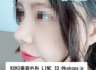 当院で鼻の手術をした患者様の自撮り写真です。