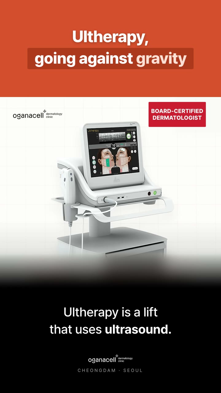 Ultherapy: why placement matters
