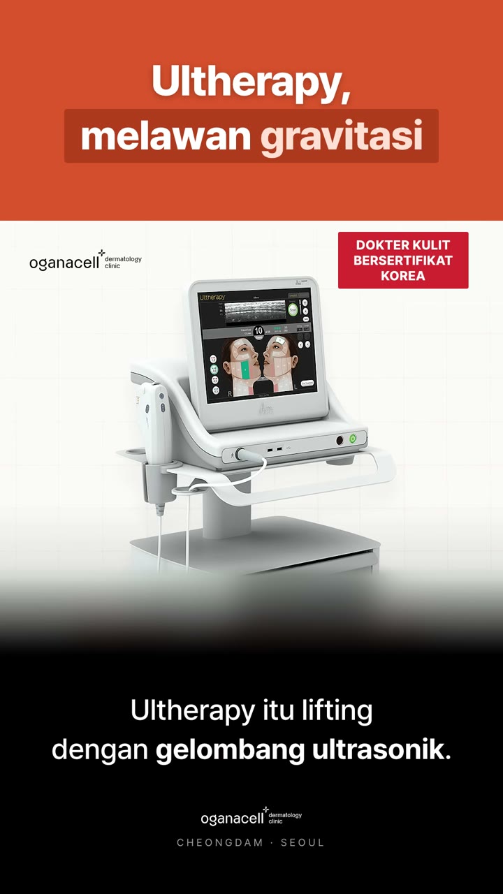 Ultherapy: area perawatan itu penting