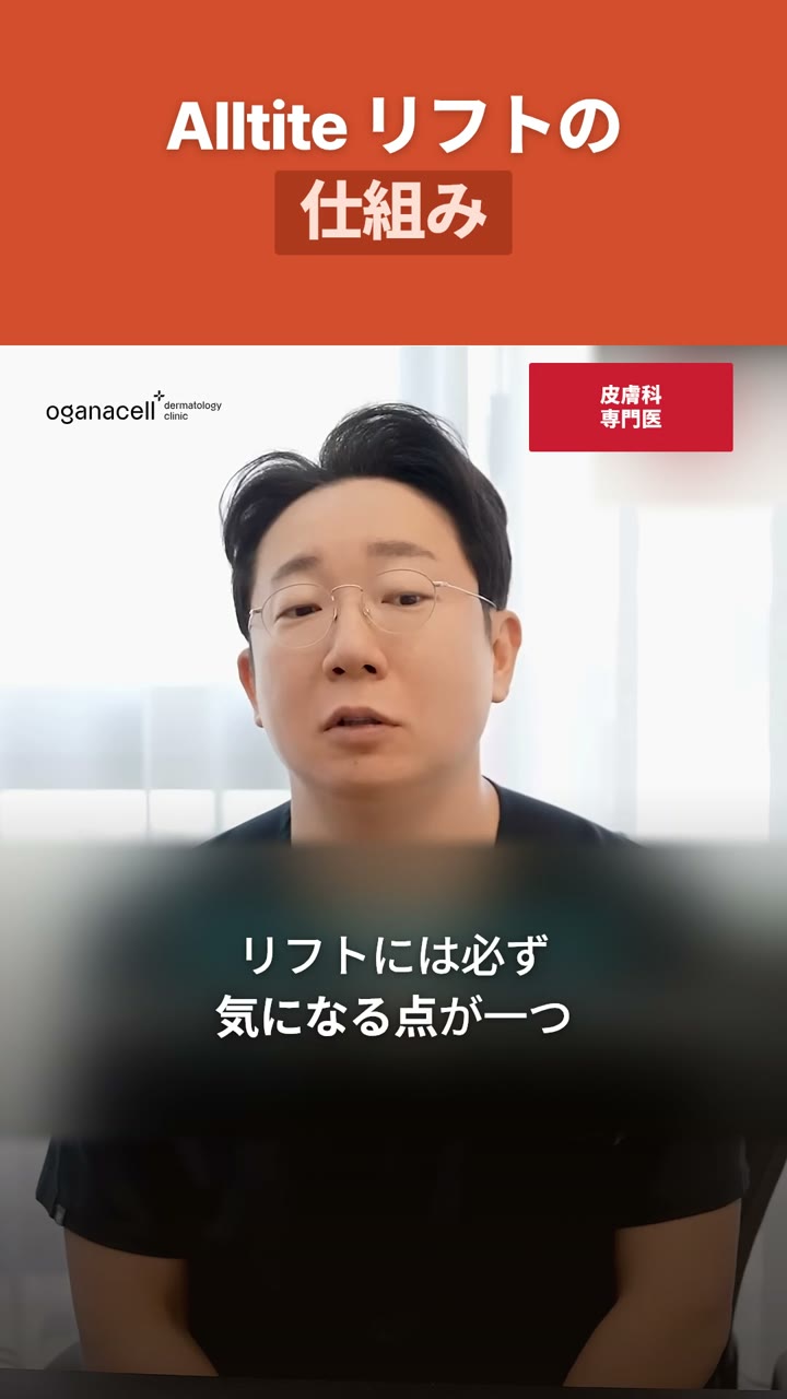 Alltiteを選ぶ前に確認したいこと