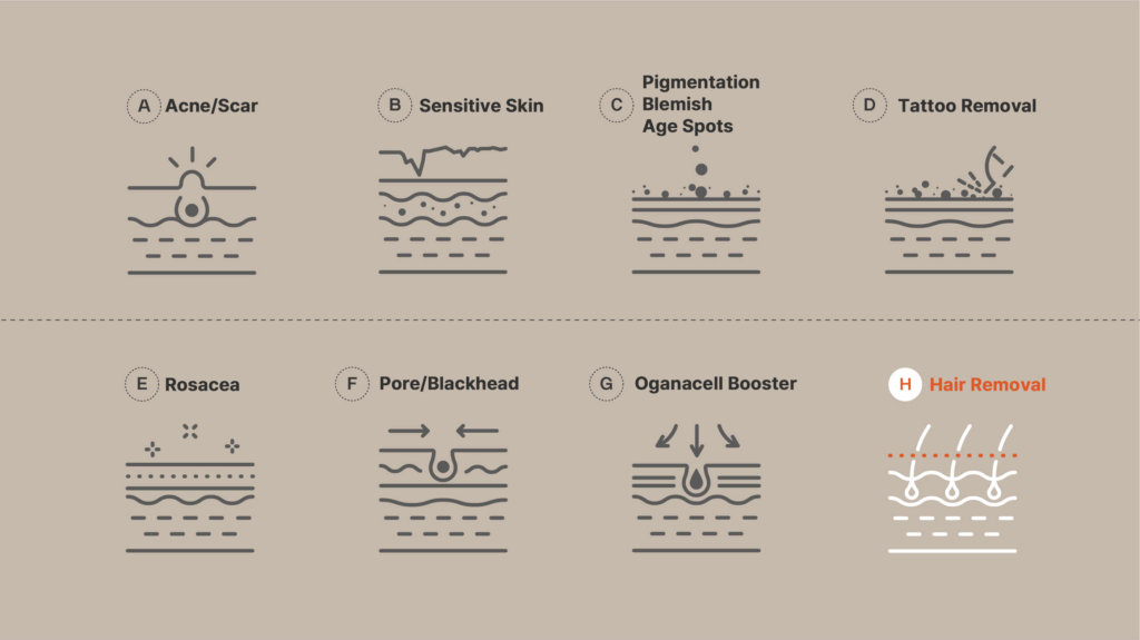 Diagram showing treatments for Acne/Scar, Sensitive Skin, Pigmentation, Blemish, Age Spots, Tattoo Removal, Rosacea, Pores, Blackheads, Oganacell Booster, and Hair Removal