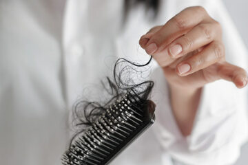 Weak hair roots due to pulling or tying hair too tightly.