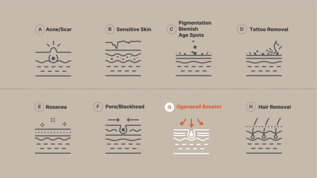 Diagram showing skincare issues and treatments including Acne/Scar, Sensitive Skin, Pigmentation Blemish Age Spots, Tattoo Removal, Rosacea, Pore/Blackhead, Oganacell Booster, and Hair Removal