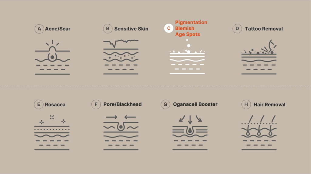 Detailed infographic showcasing various skin concerns and solutions, including acne scars, sensitive skin, pigmentation, blemishes, age spots, tattoo removal, rosacea, pore blackheads, oganacell booster, and hair removal treatment.