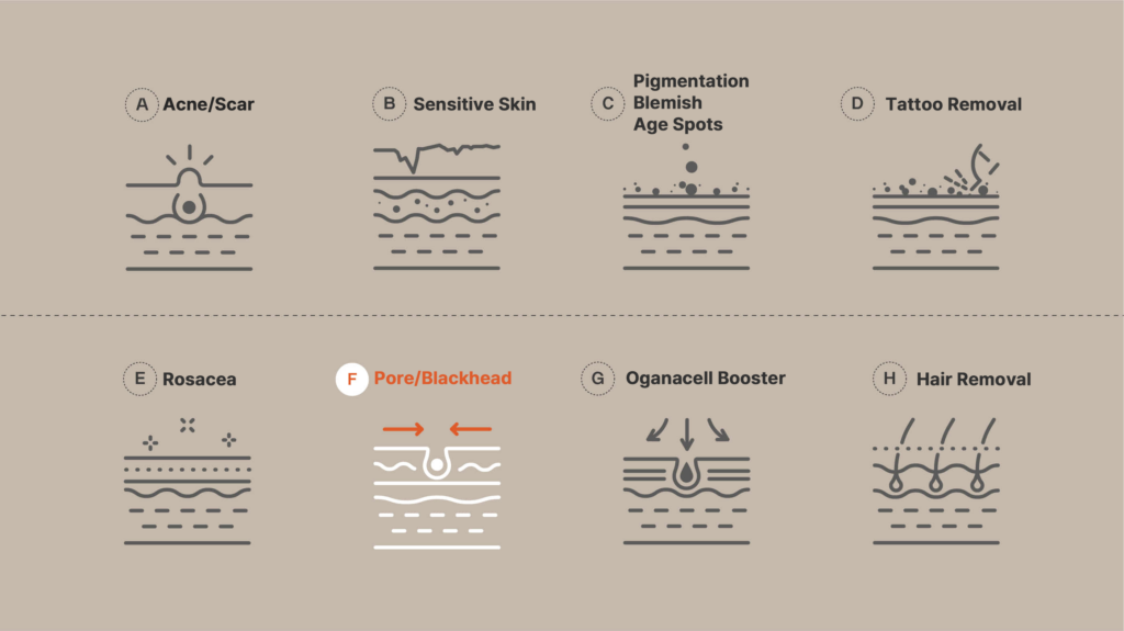 Dermatological treatments chart including solutions for acne, scars, sensitive skin, pigmentation, blemishes, age spots, tattoo removal, rosacea, pore and blackhead issues, organacell booster, and hair removal