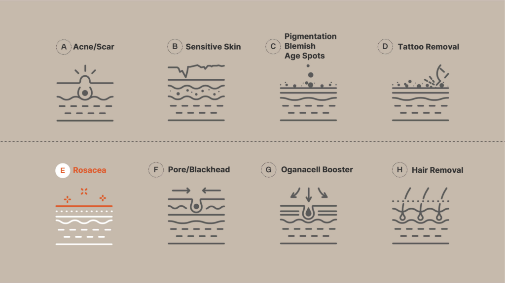 Diagram illustrating various skin conditions and treatments including Acne/Scar, Sensitive Skin, Pigmentation Blemish Age Spots, Tattoo Removal, Rosacea, Pore/Blackhead, Oganacell Booster, and Hair Removal