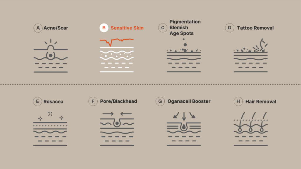 Detailed Skin Treatment Diagram Highlighting Solutions for Acne, Scars, Sensitive Skin, Pigmentation, Tattoo Removal, Rosacea, Pore Blackhead, Ogancell Booster, Hair Removal
