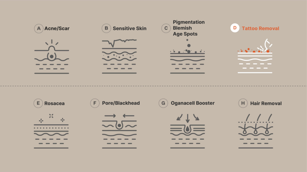 Detailed Skin Treatment Categories: Acne Scar, Sensitive Skin, Pigmentation Blemish Age Spots, Tattoo Removal, Rosacea, Pore Blackhead, Oganacell Booster, Hair Removal