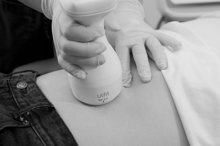 Ulfit device used for non-invasive body skin tightening procedure on abdomen