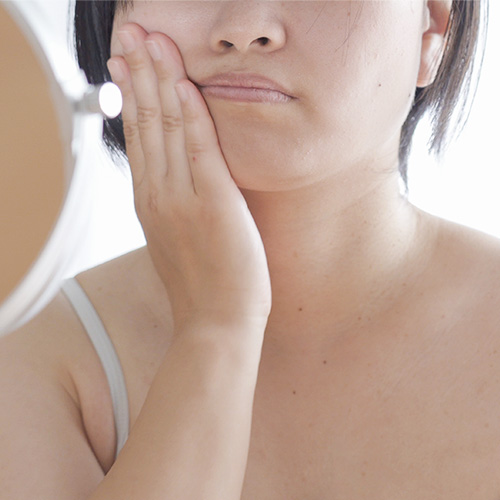 Woman touching her cheek, suffering from swelling due to poor circulation