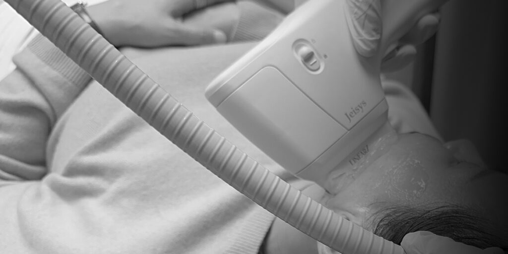 Personalized skin treatment using a LinearZ device by Oganacell for safe, less painful procedures