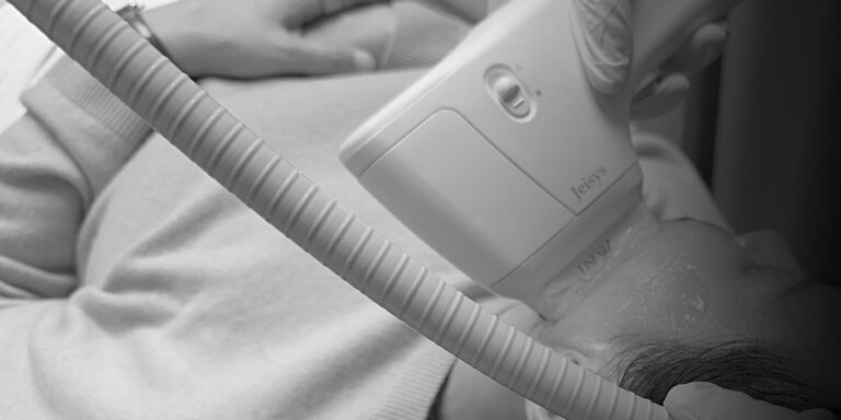 Personalized skin treatment using a LinearZ device by Oganacell for safe, less painful procedures