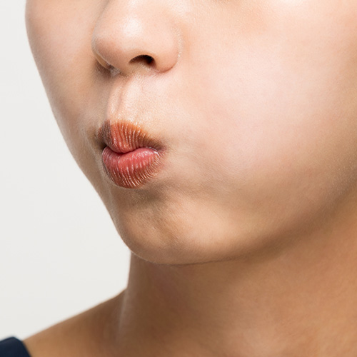 Close-up of a woman's face showing reduced skin elasticity around the mouth area