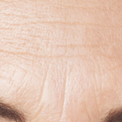 Close-up of supple skin and deep wrinkle improvement