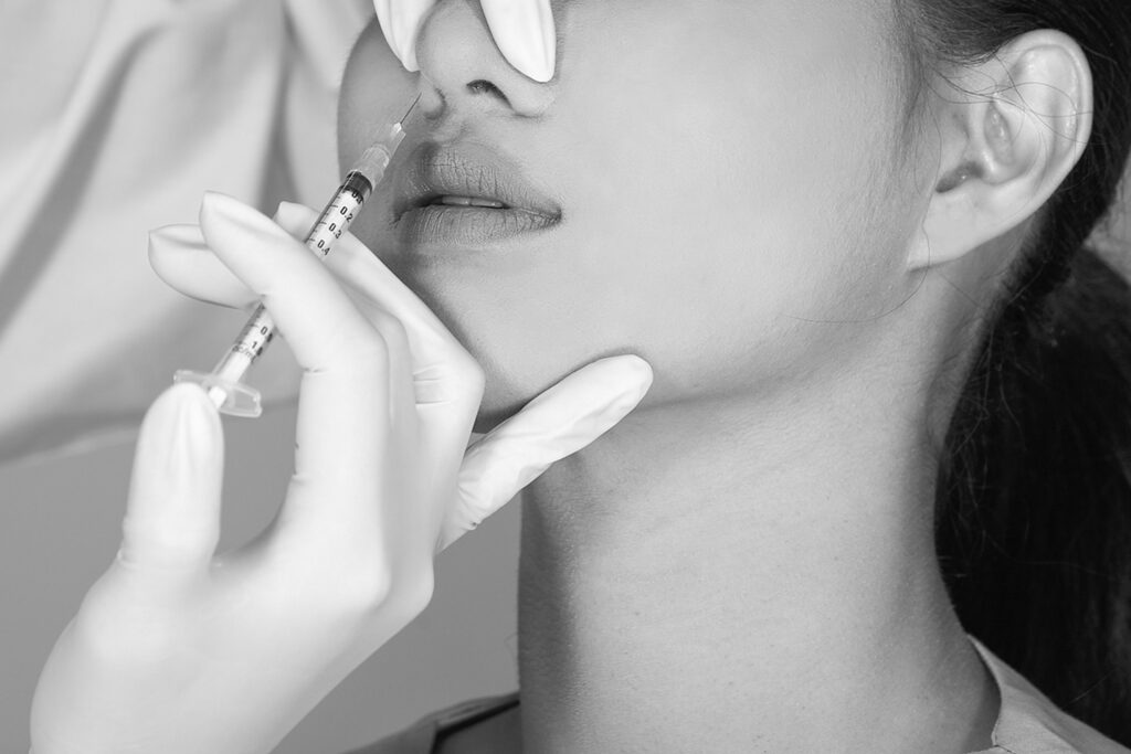 Close-up of a woman receiving facial filler injection for balanced facial contouring, targeting the lip area performed by a professional in medical gloves.