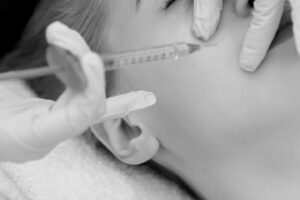Restoring Volume With Sculptra