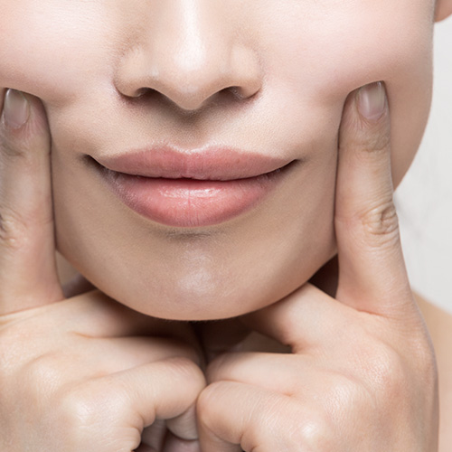 Round face shape due to cheek fat, with woman's hands cupping cheeks