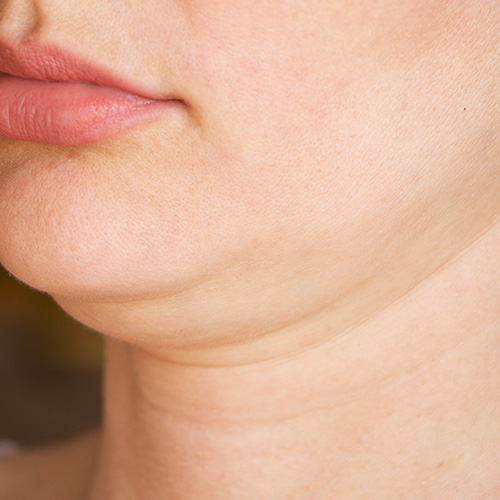 Close-up of double chin, creating synergy with dieting