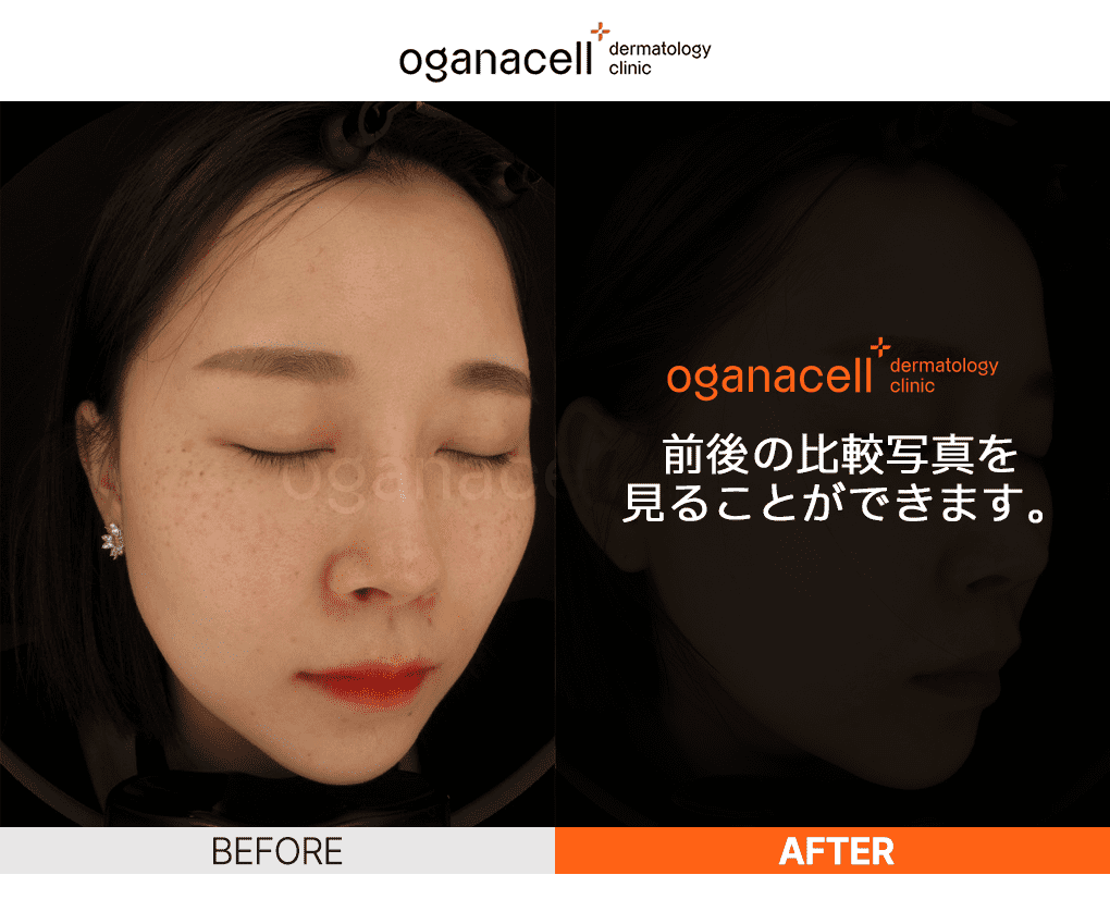 oganaskin 01