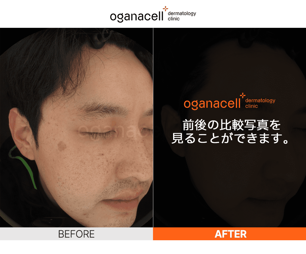 oganaskin 02
