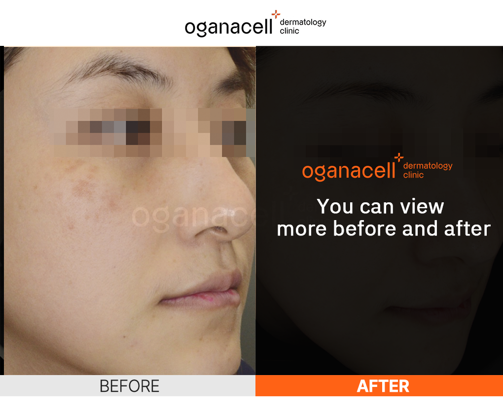 oganaskin 03 en