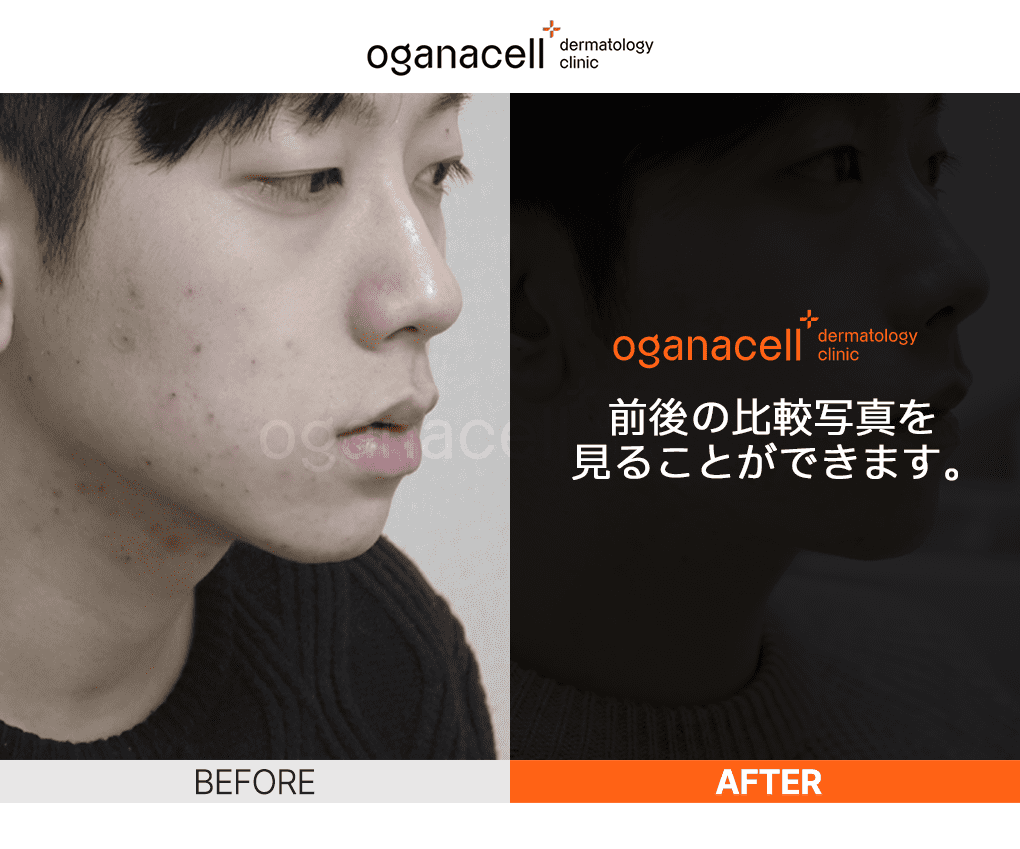 oganaskin 04