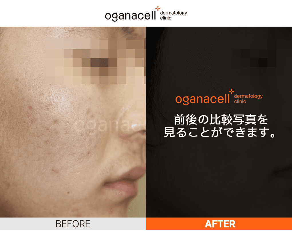oganaskin 05