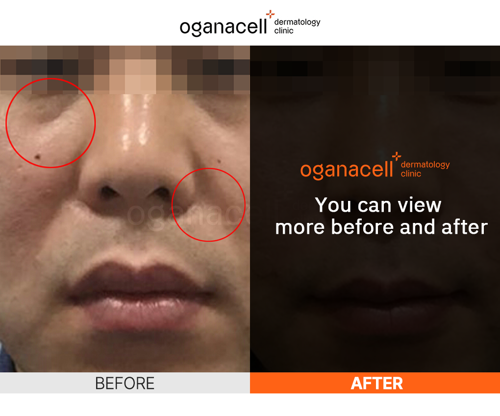 oganaskin 06 en