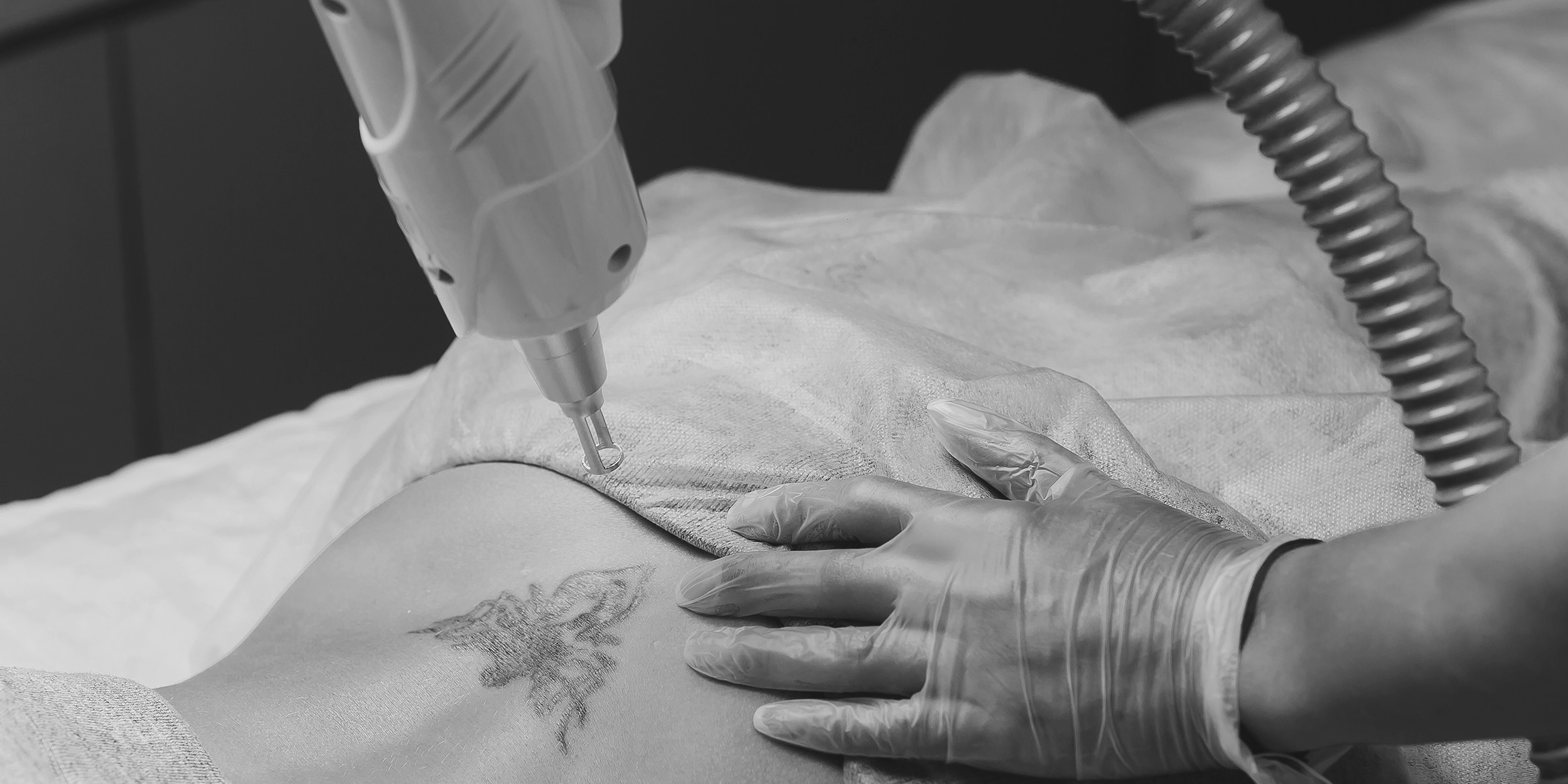 Tattoo Removal at Oganacell Cheongdam