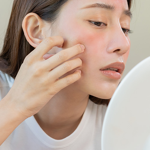 Young woman examining red, irritated skin on her cheek in the mirror, looking concerned about skin issues and seeking skincare solutions.