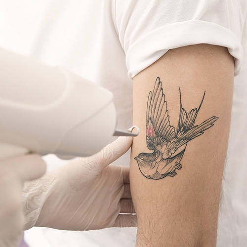 Process of getting a monochrome tattoo with a tattoo artist's needle in action.