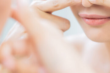 Close-up of a woman struggling with blackheads and whiteheads, affecting smooth makeup application