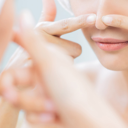 Close-up of a woman struggling with blackheads and whiteheads, affecting smooth makeup application