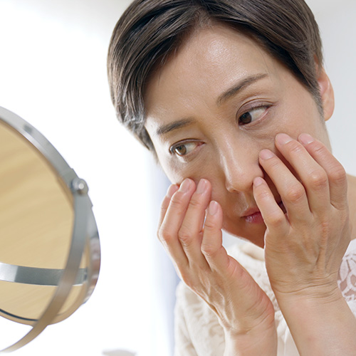 Close-up of facial skin with enlarged pores and sagging due to aging, showing visible texture and skin concerns