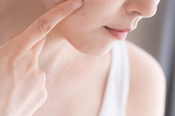Close-up of woman examining acne on her cheek, skincare routine
