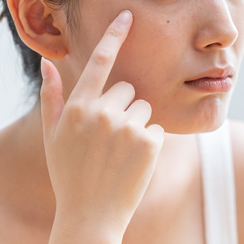 Close-up of a person with sensitive skin touching their cheek, ideal for regular hair removal