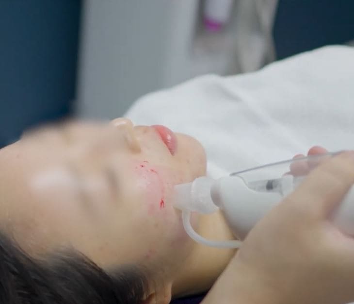 skin aging procedures at Oganacell Premium Foreigner-friendly Dermatology Clinic, Gangnam branch (Cheongdam), Seoul, South Korea.
