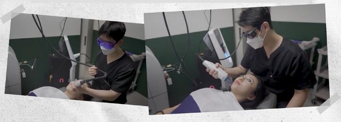 laser acne scars treatment at Oganacell Premium Foreigner-friendly Dermatology Clinic, Gangnam branch (Cheongdam), Seoul, South Korea.