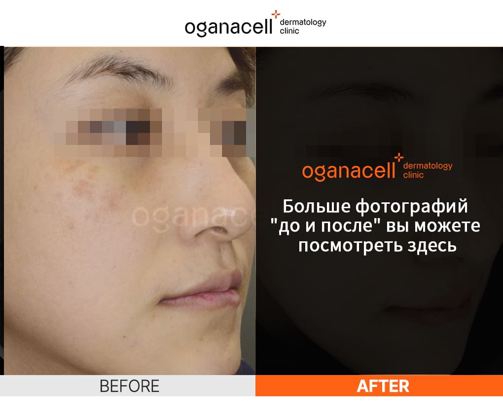 oganaskin 03 ru
