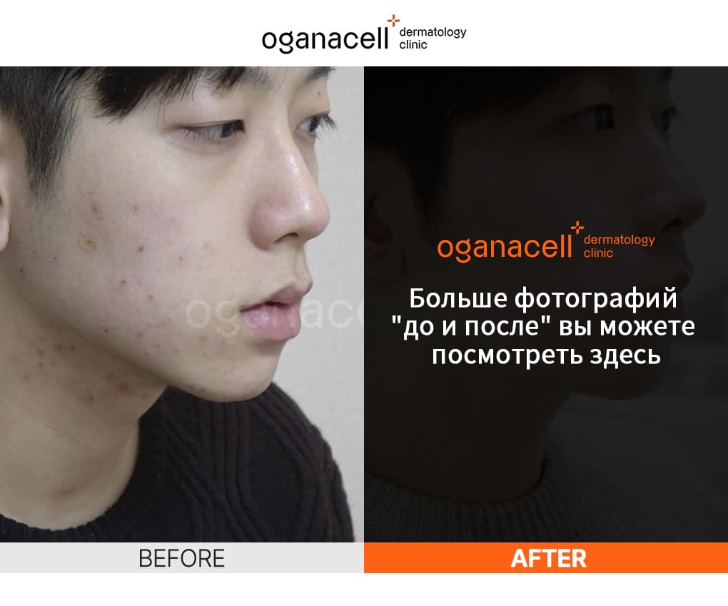 oganaskin 04 ru