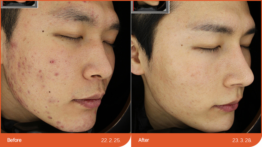 B&A_skincare_01