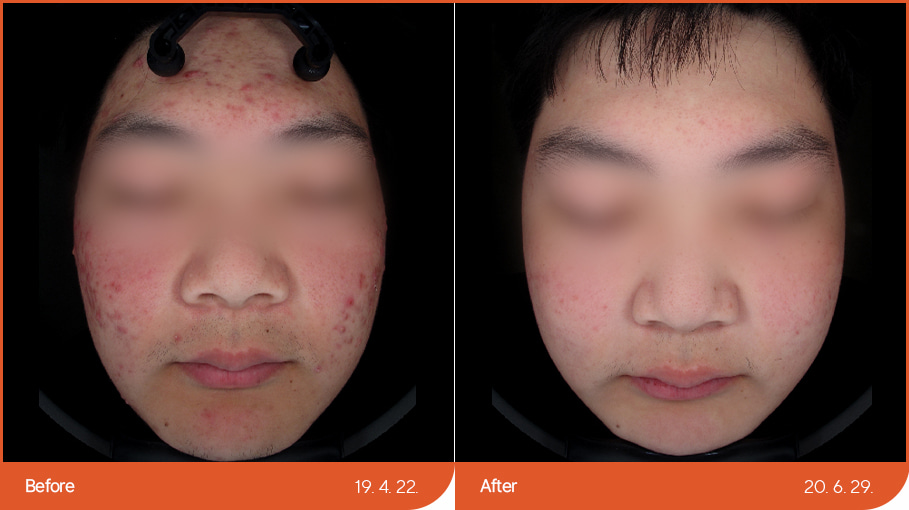 B&A_skincare_02