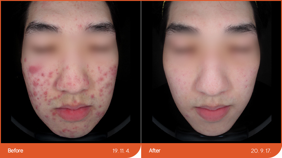 B&A_skincare_03