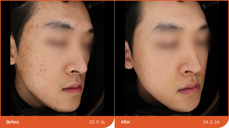 B&A_skincare_04