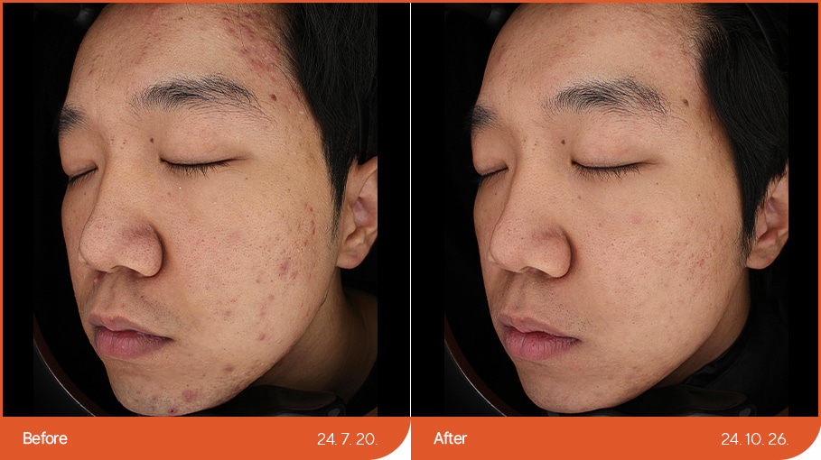 B&A_skincare_05