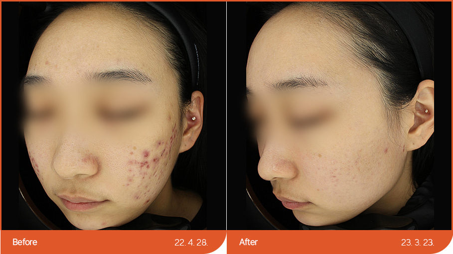B&A_skincare_06