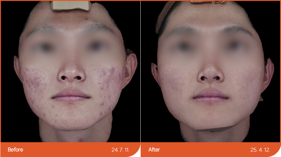 B&A_skincare_07