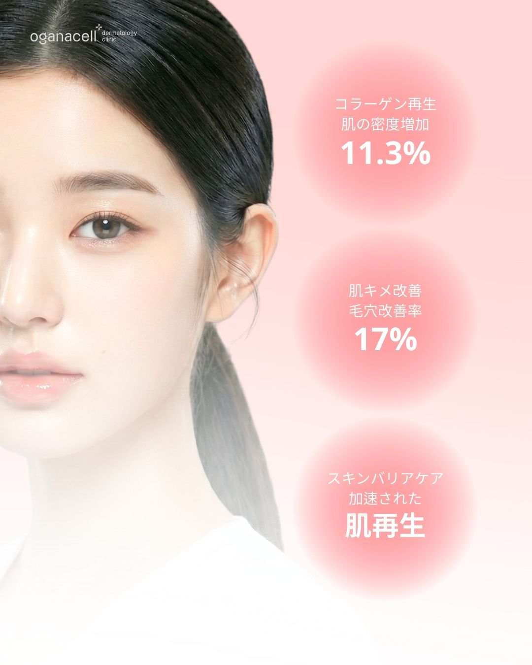 オガナセル皮膚科の広告ビジュアルです。透明感のある肌を持つ女性の顔の横に、施術の効果を示す3つのピンク色の円が並んでいます。上から順に、「コラーゲン再生・肌の密度増加 11.3%」、「肌キメ改善・毛穴改善率 17%」、「スキンバリアケア・加速された肌再生」と記載されており、具体的な改善数値と肌再生効果を強調しています。